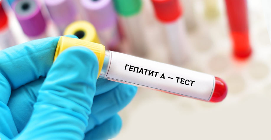 Гепатитом А у Києві захворіли вже 65 людей, серед них — 31 дитина